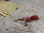 кровь_на_ткани_через_5_часов.jpg
