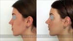 glushko-result-ortho-5.jpg